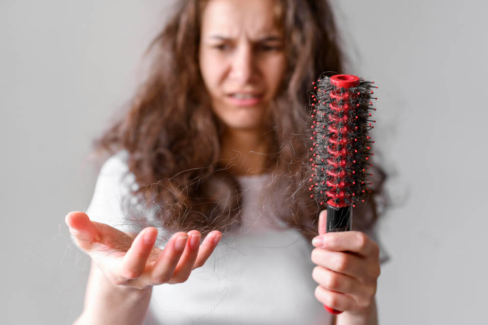 Hair Loss in Women