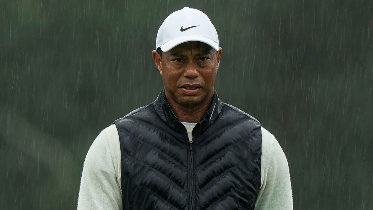 Tiger Woods Hair Transplant 1 Tiger Woods Hair Transplant