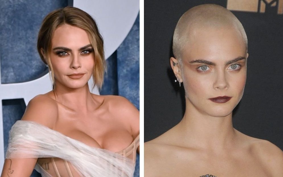 41 Famous Bald Celebrities