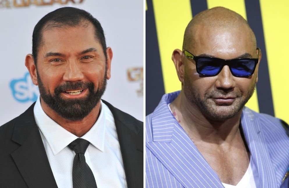 41 Famous Bald Celebrities
