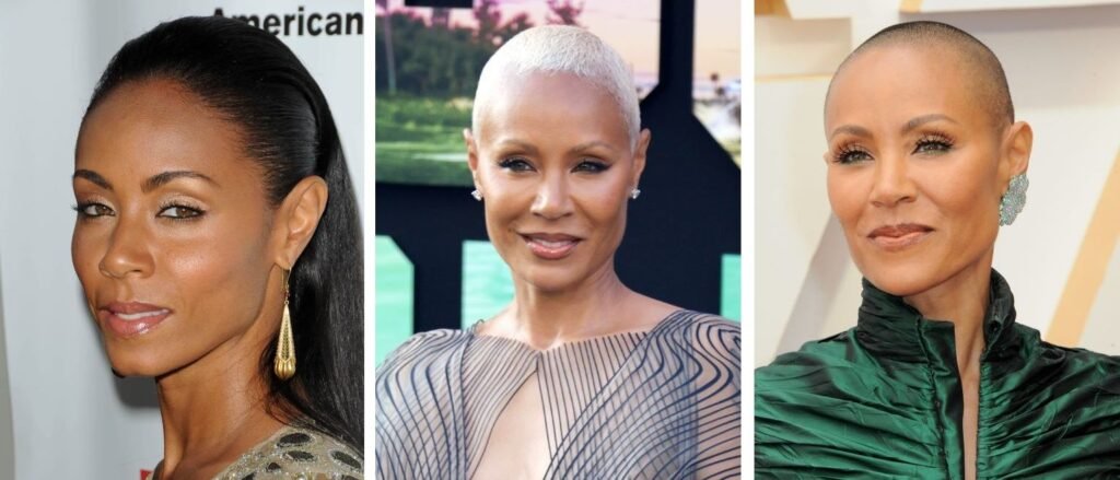 41 Famous Bald Celebrities