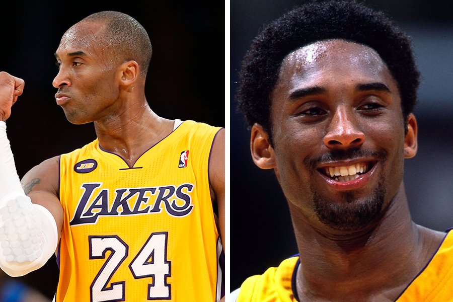 41 Famous Bald Celebrities