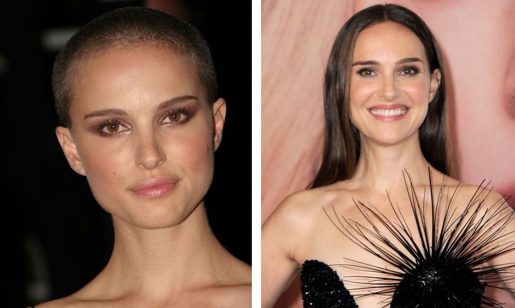 41 Famous Bald Celebrities