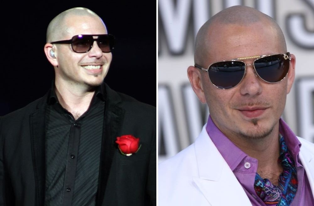 41 Famous Bald Celebrities