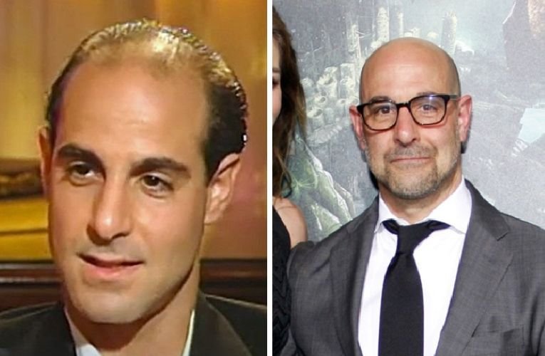 41 Famous Bald Celebrities