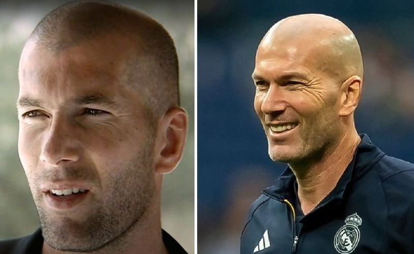 41 Famous Bald Celebrities