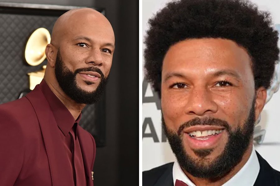 41 Famous Bald Celebrities