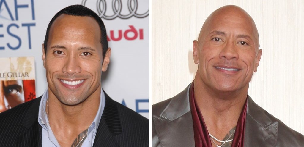 41 Famous Bald Celebrities