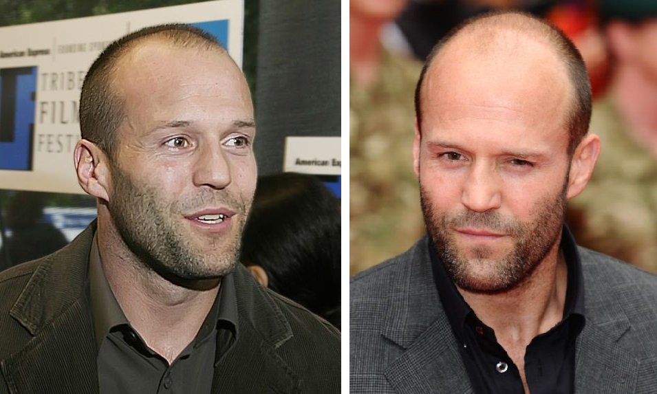 41 Famous Bald Celebrities