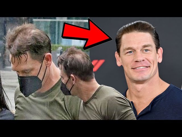 john cena hair transplant before after